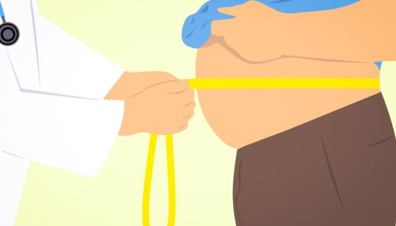 obese-3011213_960_720